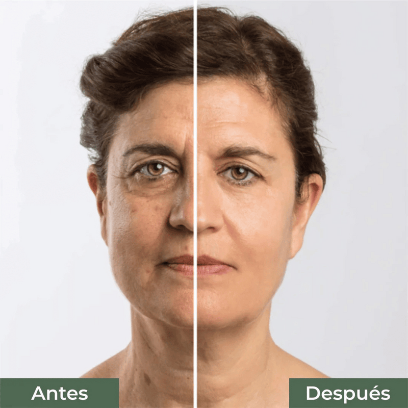 ®Natural Life - Antiarrugas